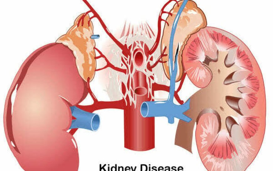 Rising Drug Abuse Among Youths Fuelling Kidney, Liver Diseases – Expert