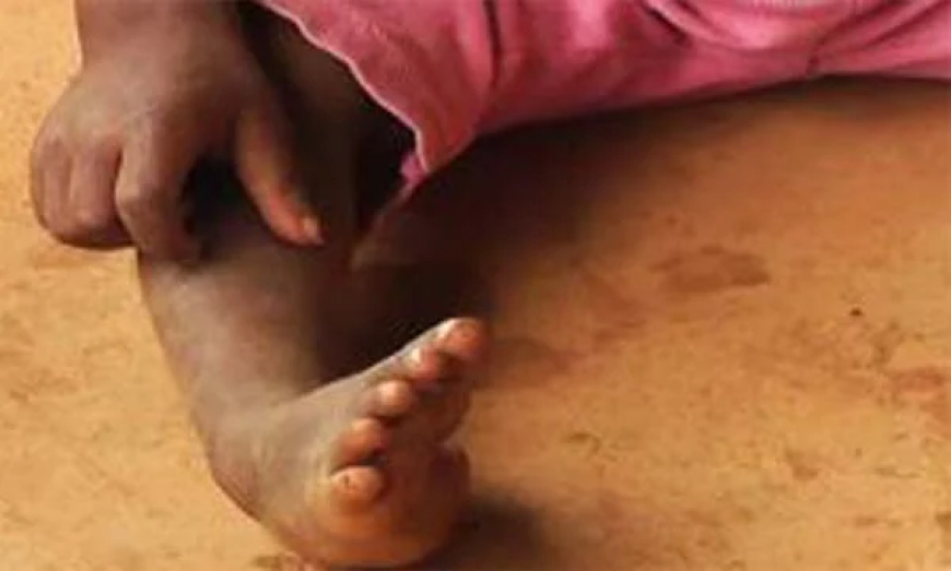 Sokoto sets 2026 deadline to end polio